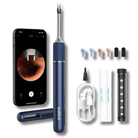 Otoskop z kamerą do czyszczenia uszu Bebird Note 5 regulowana stabilizacja